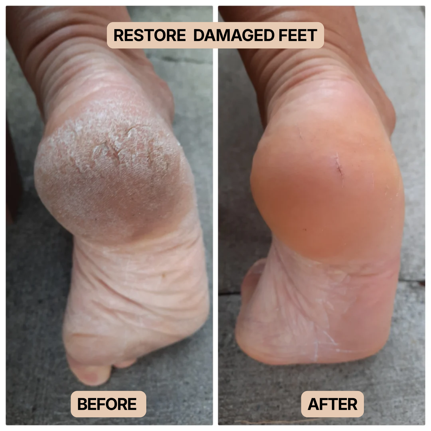 Solera Electric Callus Remover